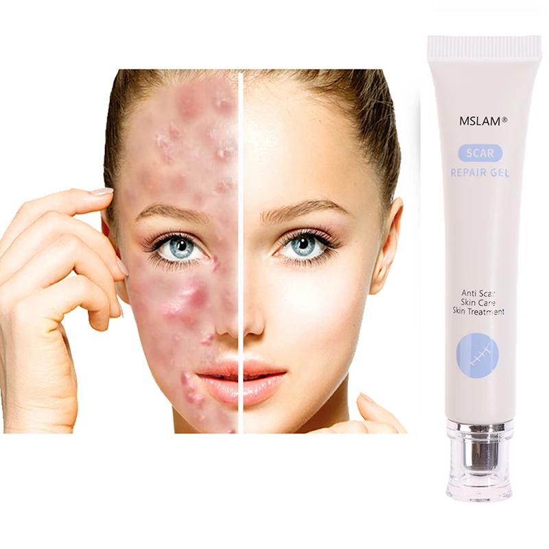 MSLAM Scar Gel 0.71 Oz Cream Soften Sooth Scars Treatment Repair Wound Removal 1 PACK
