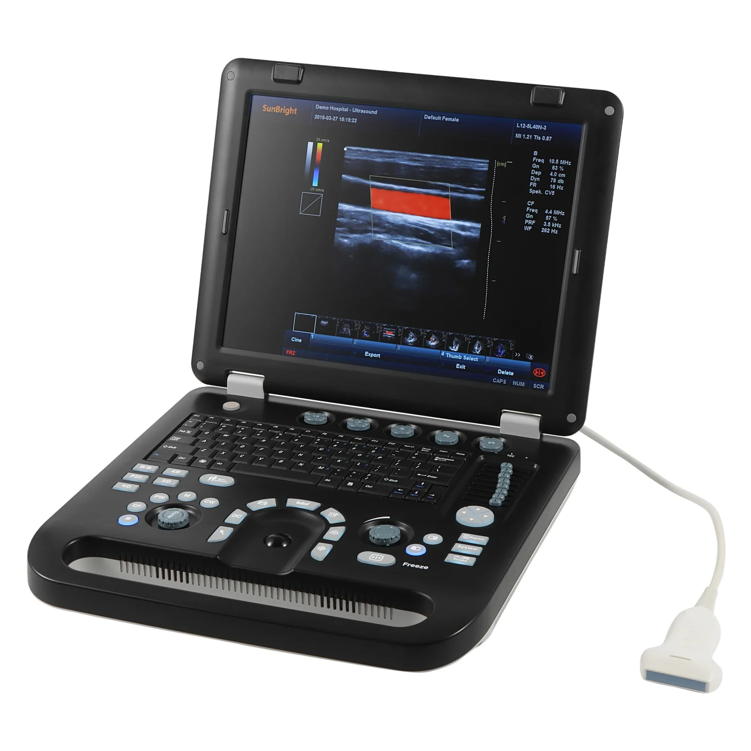 SUN-906A LED high resolution Color Doppler ecography Doppler color 3D ultrasound