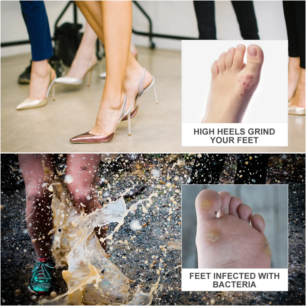 

ROSENICE 12 Sheets 108PCS Self Adhesive Callus Cushions Soft Corn Pads Waterproof Toe and Foot Protectors