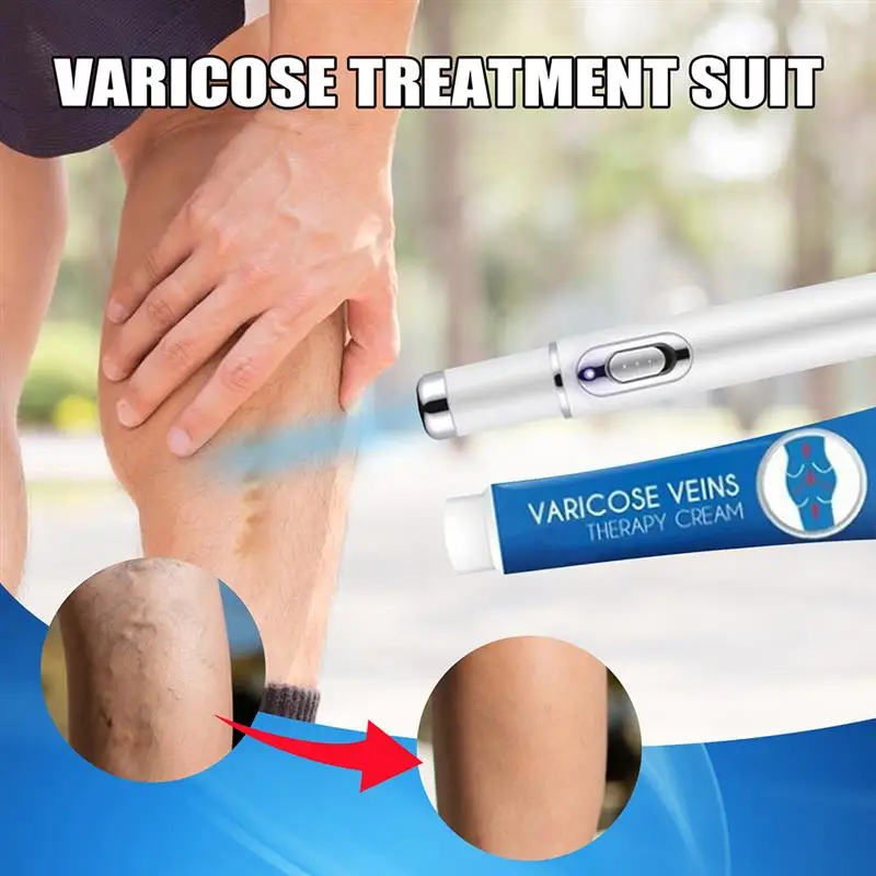 Набор для лечения варикозного расширения вен набор крем и ручка сисветильник |
