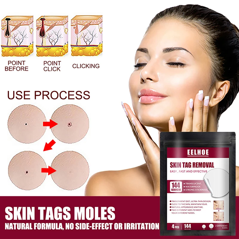 

144 Pcs Acne Skin Tag Warts Remover Patch Treatment Invisible Stickers Skin Care