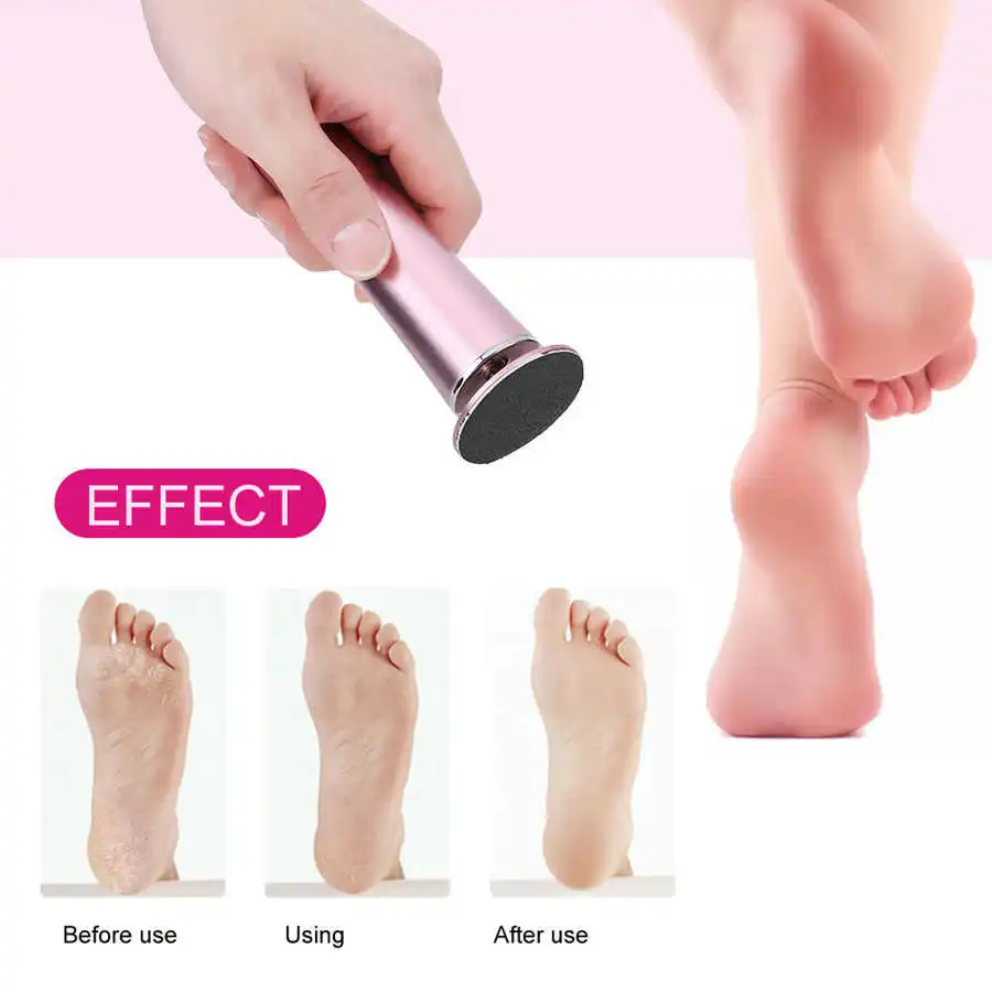 

1set Foot Care Electric Foot Callus Remover Exfoliate Dead Skin Removal Foot Grinder File Pedicure Tool Pedicure Tools