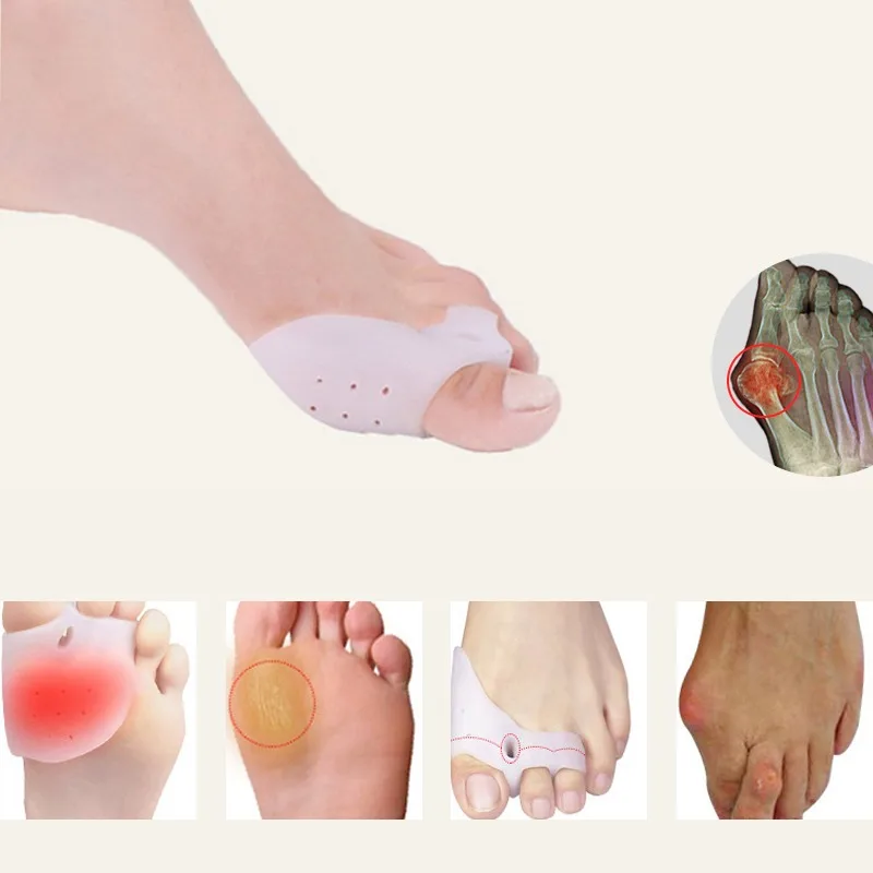 

2Pairs Gel Foot Care Tool Bunion Corrector Bone Big Toe Protector Hallux Valgus Straightener Toe Spreader Pedicure Corrector