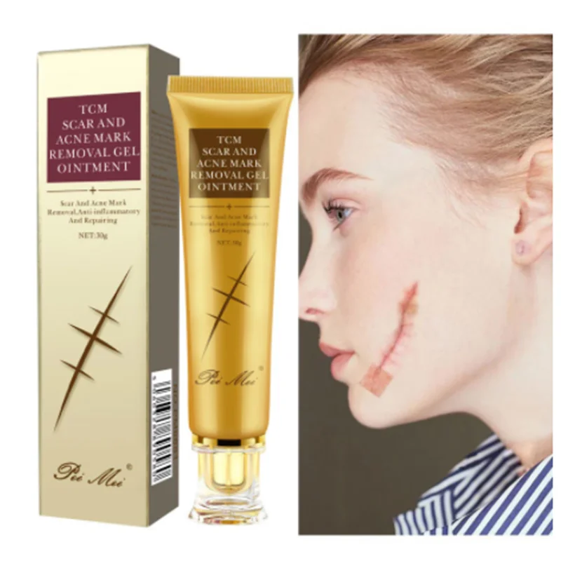 

Acne and Scar Cream Cream Smoothes Acne Stretch Marks Repair Care Whitening Moisturizing Gel Brightening Body Skin Cream 30g