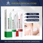 Крем для отбеливания веснушек средство для удаления мелазмы, средство для удаления мелазмы, Осветление кожи, антивозрастное Осветление кожи