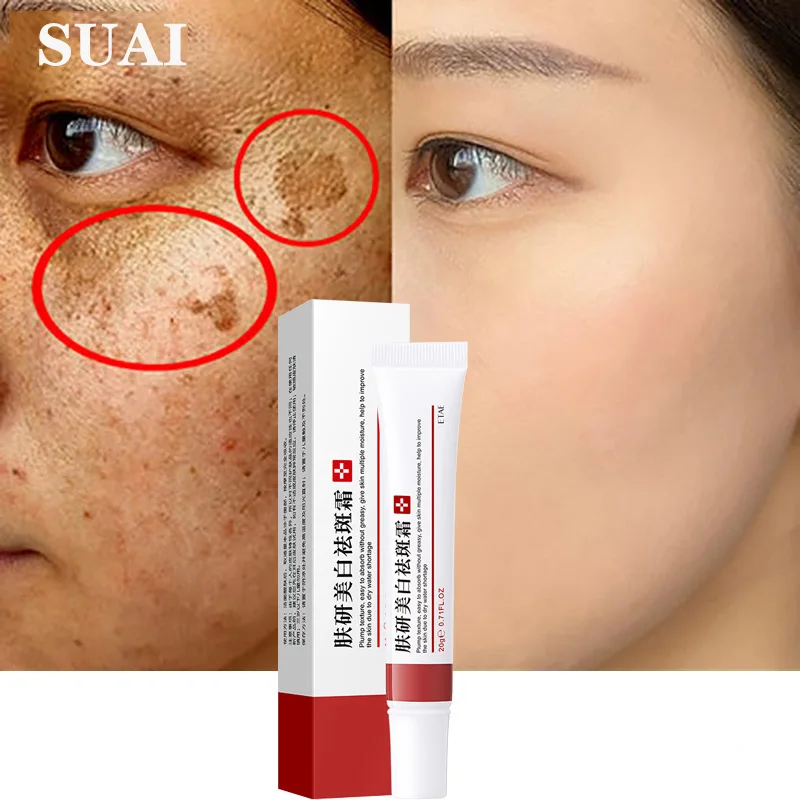 

10PCS Whitening Cream Freckle Cream Remove Melasma Acne Spot Pigment Melanin Dark Spots Pigmentation Moisturizing Gel Skin Care