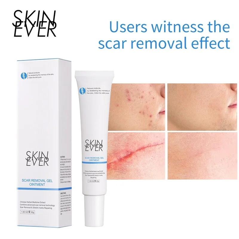 

30g Acne Scar Removal Cream Pimples Stretch Marks Face Gel Remove Acne Smoothing Whitening Moisturizing Body Skin Care