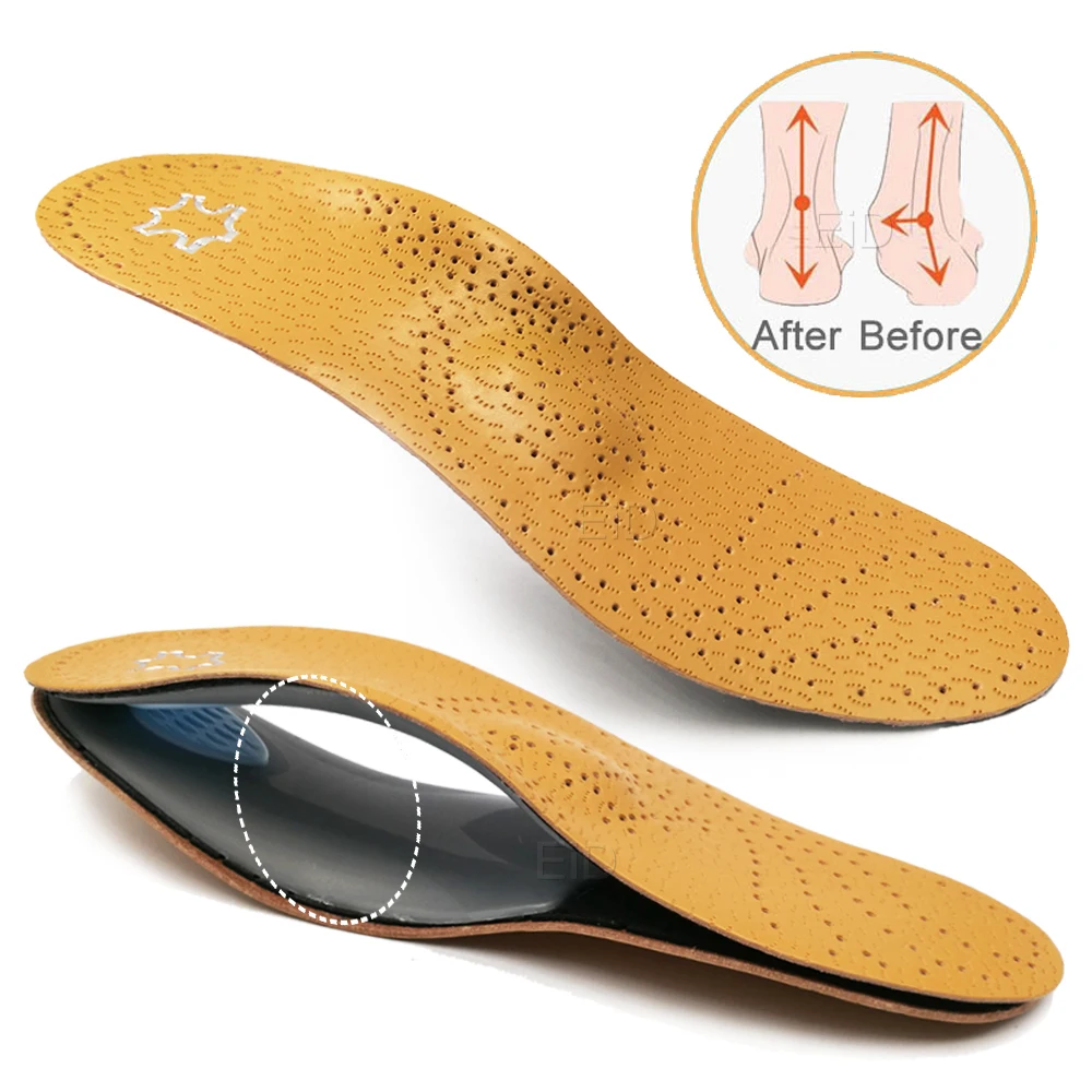 Unisex Premium Leather Orthotic insole for Flat foot Shoe Insoles High Arch Support orthopedic Pad for Correction OX Leg Health