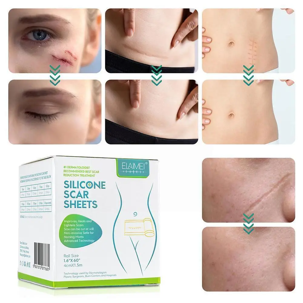 

4*1.5M Silicone Gel Efficient Beauty Scar Removal Silicone Self Gel Scar Reduce Silicone Adhesive For Acne Gel Burn Tape Pa B1Y8