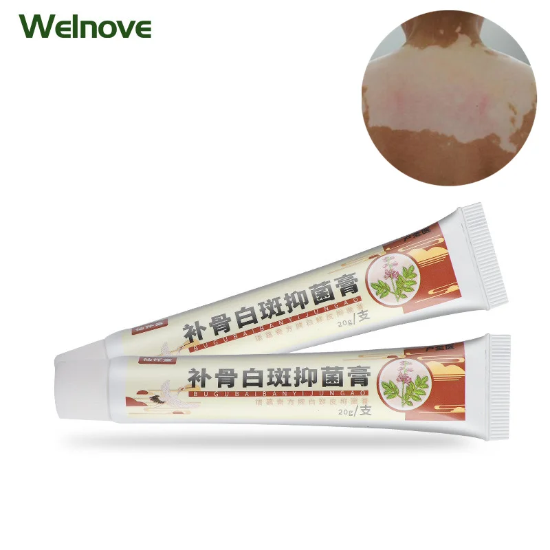20 г Китайский чай витилиго крем белое пятно Антибактериальный КРЕМ пигмент