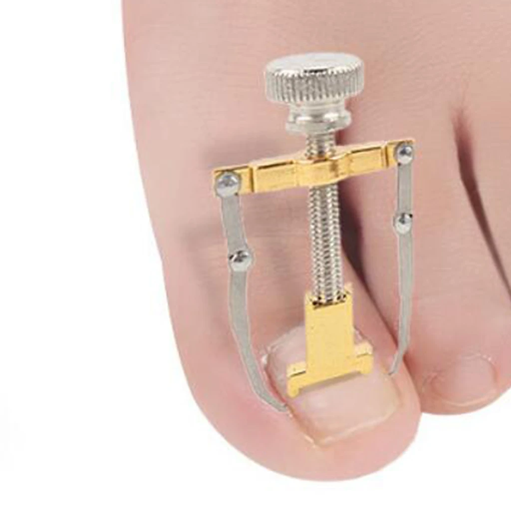 

Ingrown Toenail Lifter Fixer Toenail Corrector Treatment Tool Foot Care