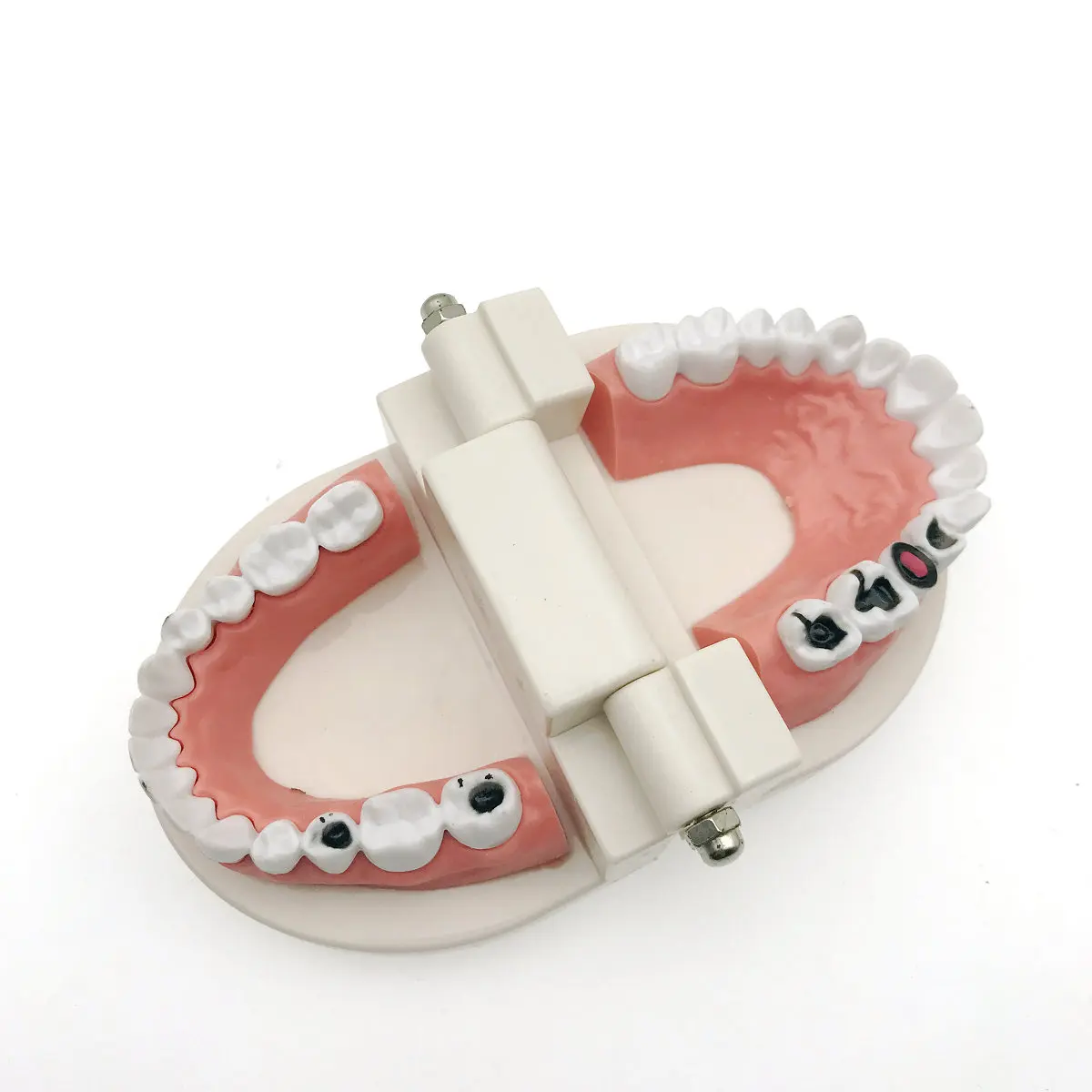 Модель для обучения стоматологии кариеса модель демонстрация размер