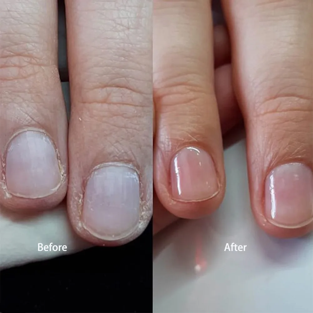 Гель KODIES профессиональная структура гель для ногтей УФ Усиленный резиновый