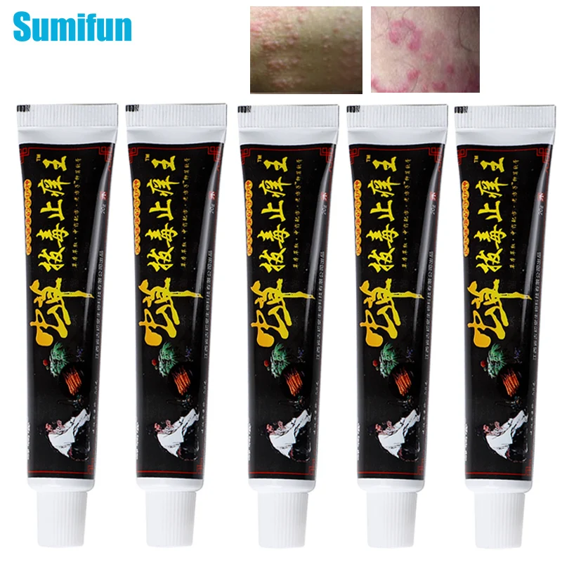 

3/5Pcs Eczema Cream Herbal Antibacterial Antipruritic Ointment Psoriasi Pruritus Bacterial Infection Foot Odor Beriberi Ointment