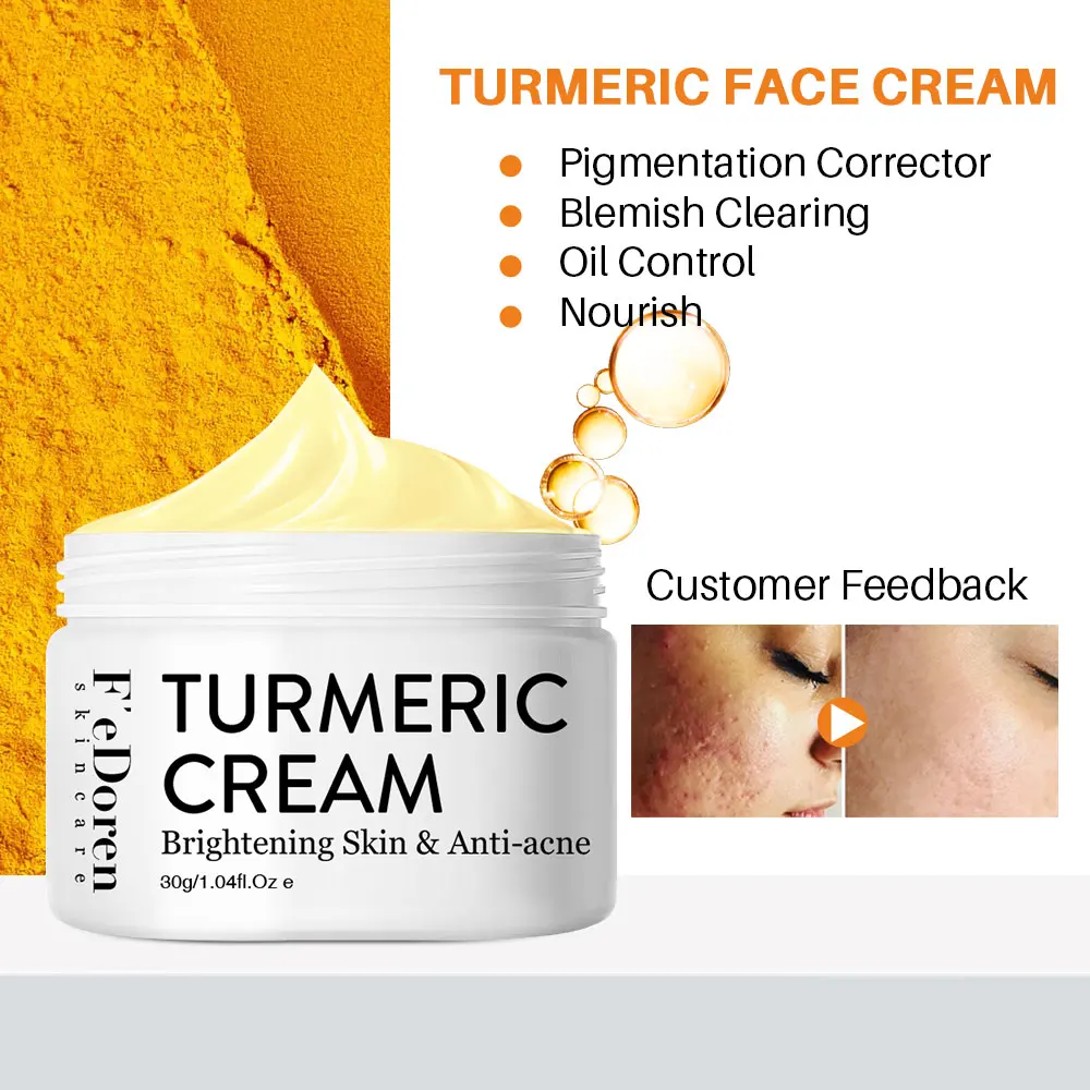 

Hot Sale 30ml Turmeric Face Cream Repair Acnes scar Dark spot Treatment Moisturizer Whitening Lightening Against Acne Skin care