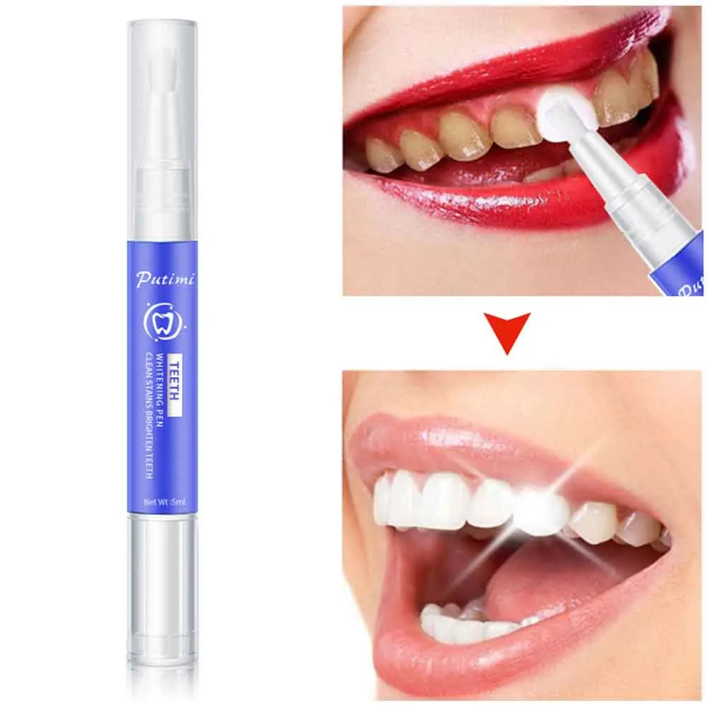 5 мл средство для мгновенного удаления пятен отбеливания полости рта портативная