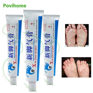 3 предмета, крем для ног кукурузы удаления для ухода за стопами и руками для эрозионной разъедание кожи против зуда запаха пота средства ухода за кожей стоп от псориаза, антибактериальная мазь P1028
