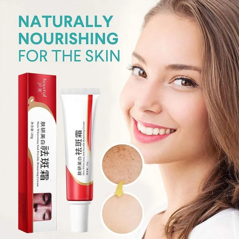 20ml Whitening Fades Spots Cream Repair Face Freckle Acne Scar Creams Shrink Pores Oil Control Moisturizer Skin Care