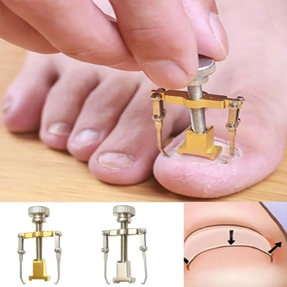 

50% Hot Sale Ingrown Toenail Toe Fixer Recover Correction Device Pedicure Foot Nail Care Tool