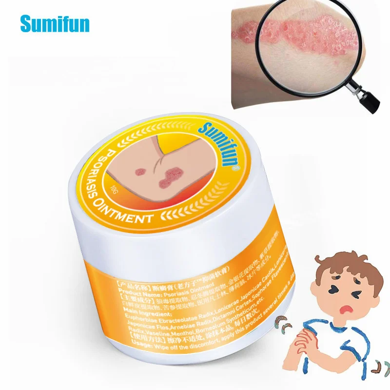 

10g Skin Psoriasis Cream Dermatitis Eczematoid Eczema Chinese Herbal Ointment Treatment Antibacterial Rash Urticaria Skin Care