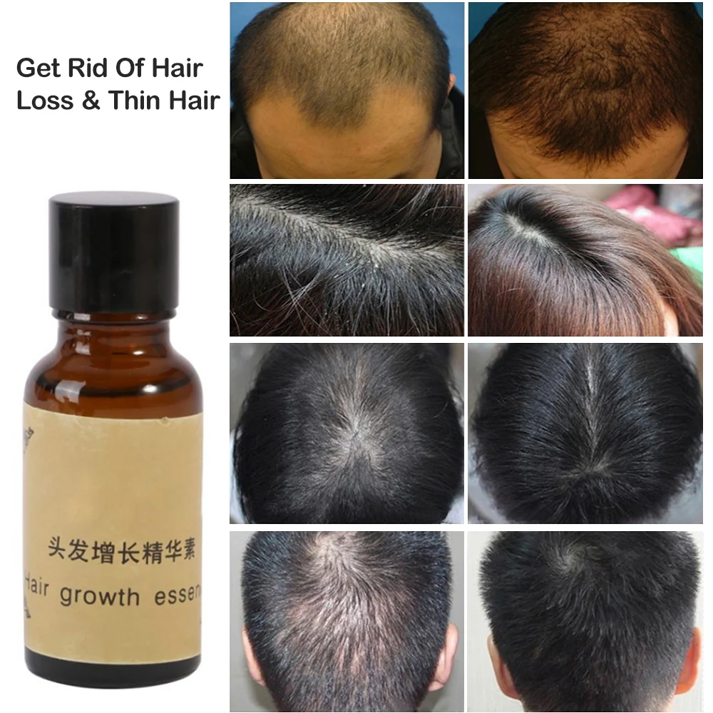 Жидкий Усилитель роста волос выпадение утолщение лечение формула сыворотка для