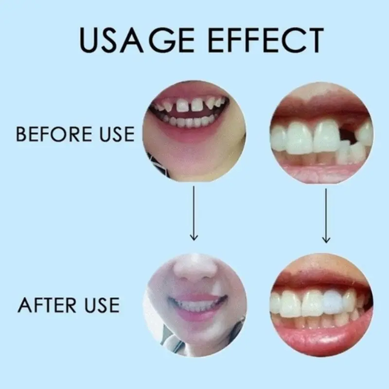 

New Temporary False Teeth Gaps Repair Kit Vampire Adhesive Denture Solid Glue Tool