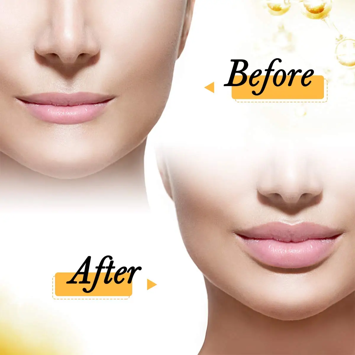 Небулайзер высокого давления с гиалуроновой ручкой пистолет для инъекций без