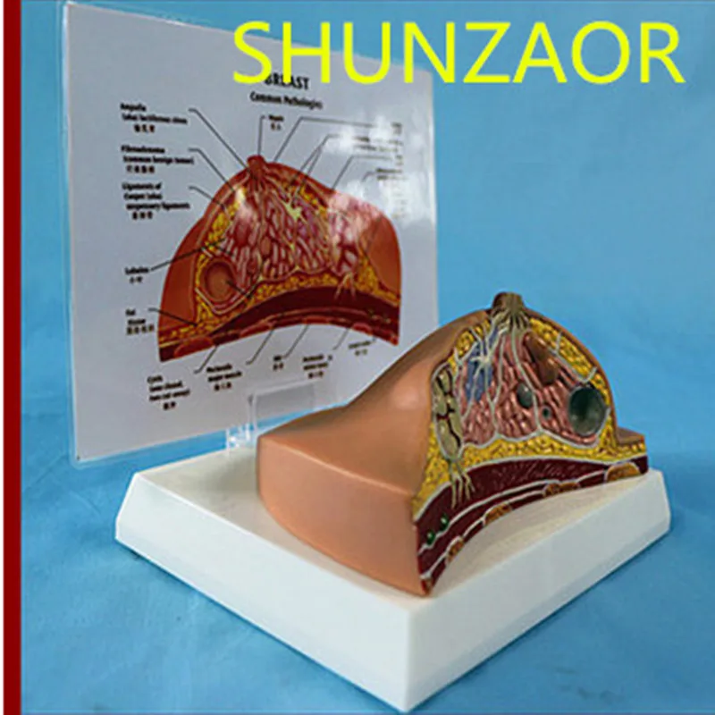 1:1 медианный отдел женской груди патологии анатомия модель комплекта настольная