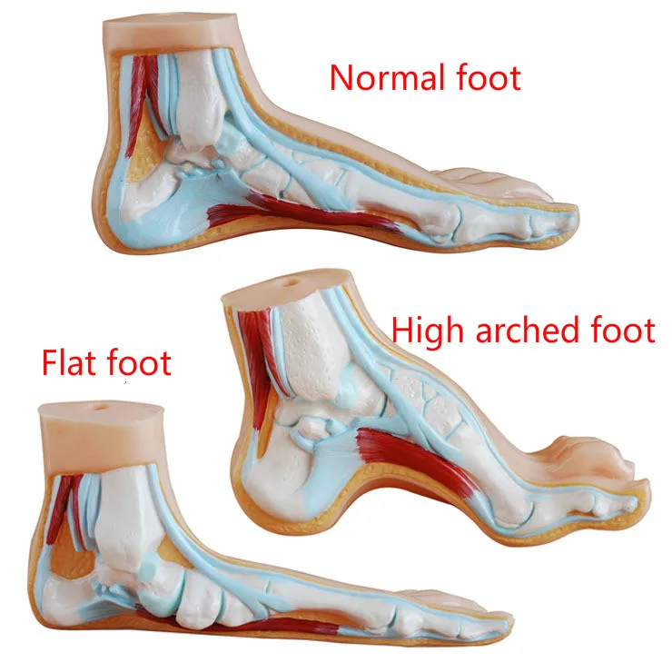 

Медицинская анатомия, человеческая нога, нормальная нога, плоская и изогнутая нога, анатомическая модель человеческого шампуера, модель пл...