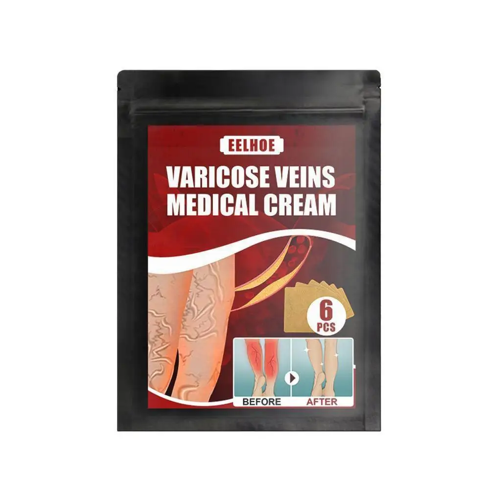 

Plaster Treatment For Varicose Veins, Medical Patch 6 Pain For Angiitis Vasculitis, Sticker, Pcs Removal, Phlebitis, Leg J0Z7