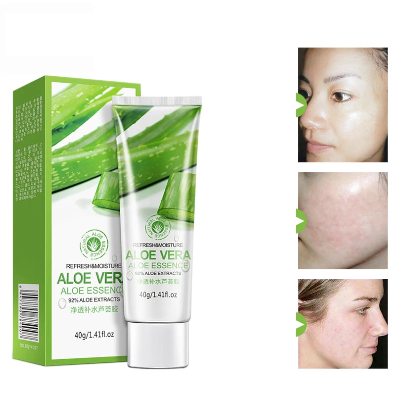 

Natural Aloe Vera Gel Face Moisturizer Whitening Anti Wrinkle Cream Acne Scar Skin Sunscreen Acne Treatment Skin Care