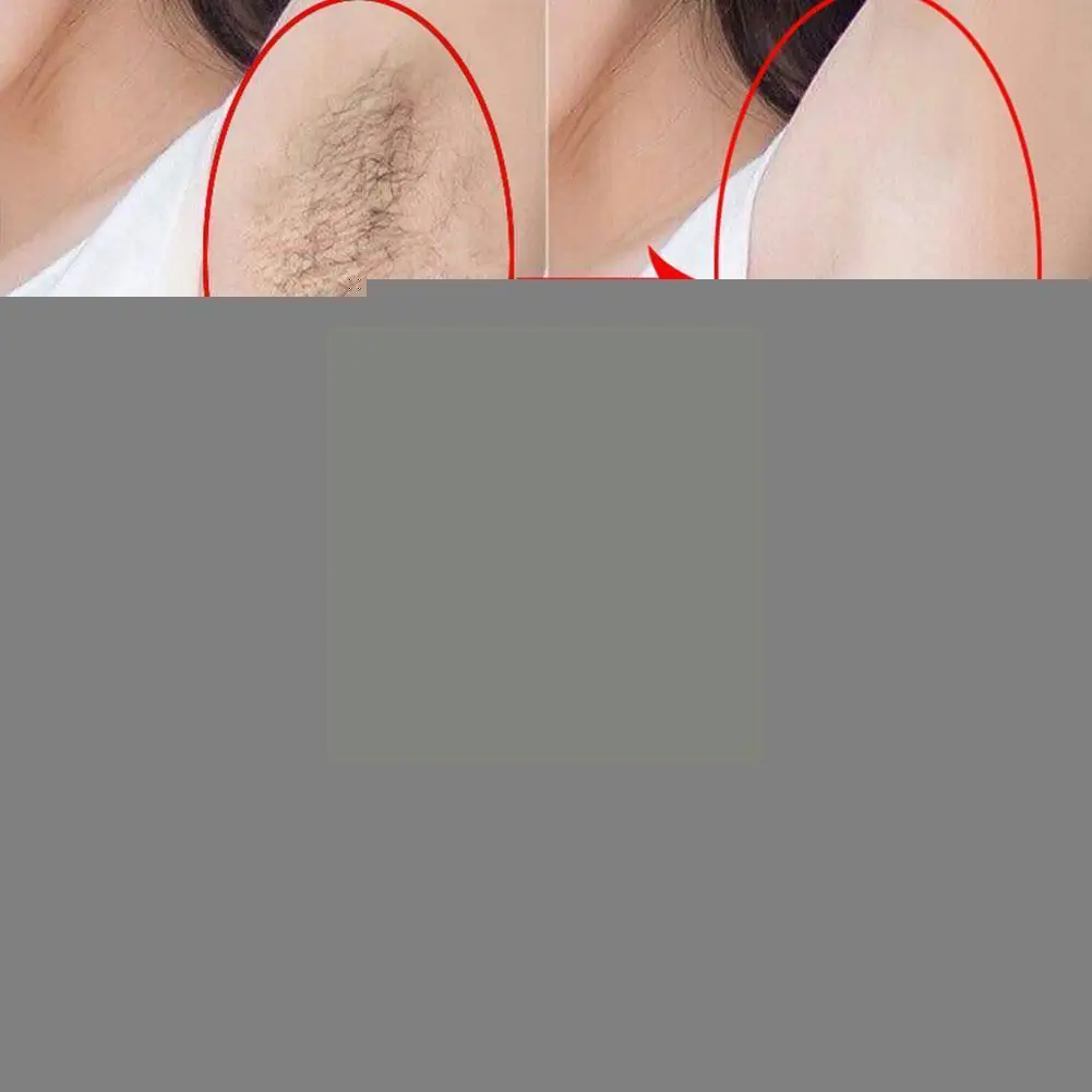 

20ml Hair Removal Spray Body Legs Armpit Beard Permanent Cream Inhibit Growth Paste Depilation Painless Spray Hair Depilato J1b3