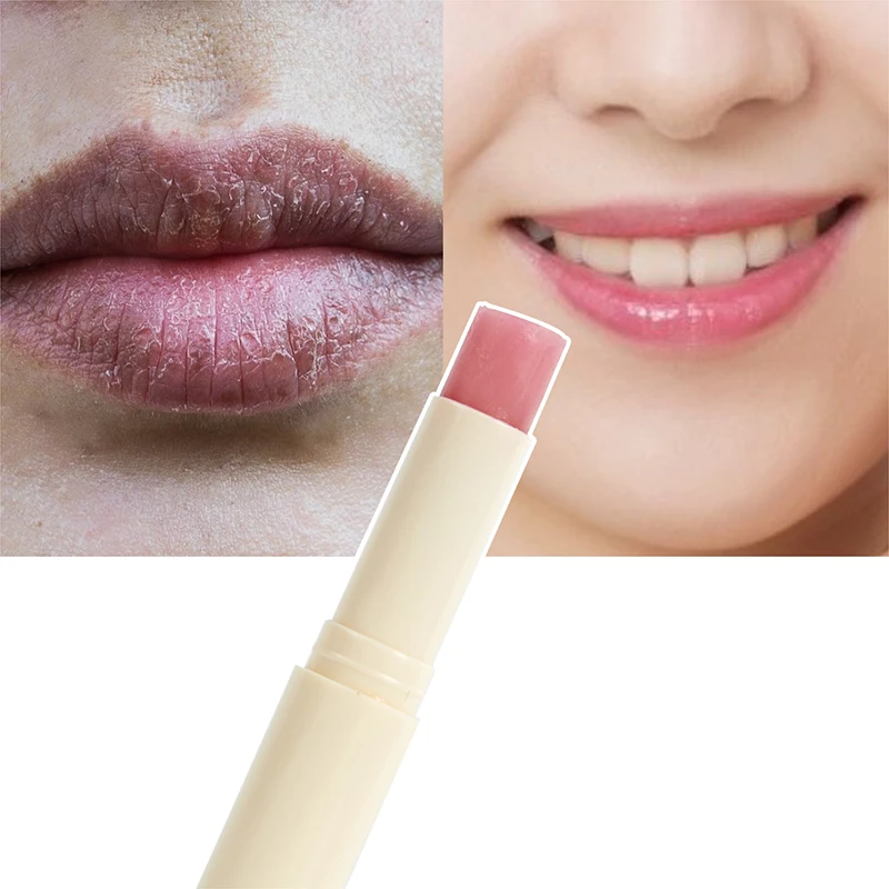 

Natural Plant Lips Bleaching Cream Treatment To Remove Black Smoke Lip Oil