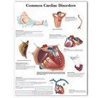 WANGART, анатомический плакат, схема распространенных сердечных заболеваний, настенная Картина на холсте для медицинского образования