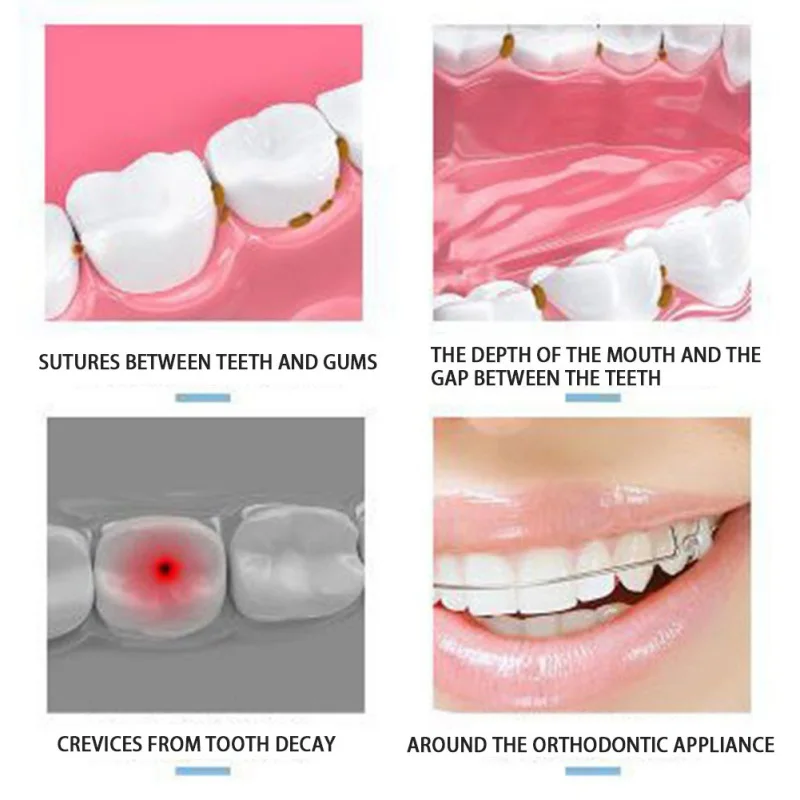 Электрический Очиститель зубов устройство для очистки полости рта портативное