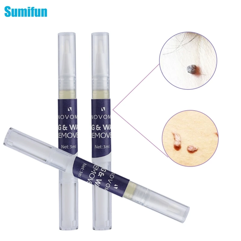 

New Skin Tag Genital Wart Remover Pen Warts Liquid From Skin Tags Removing Against Moles Remover Anti Verruca Remedy 3ml C2236