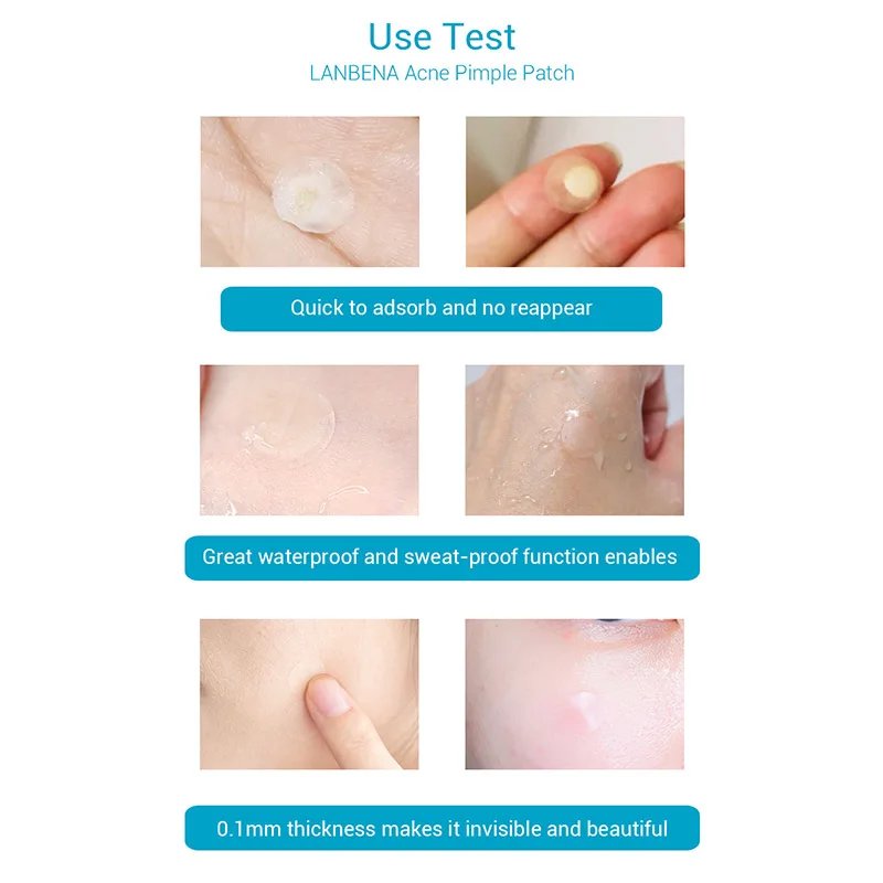 24 шт. Гидроколлоидные прыщи невидимые мастер патч снятие наклейка накладки