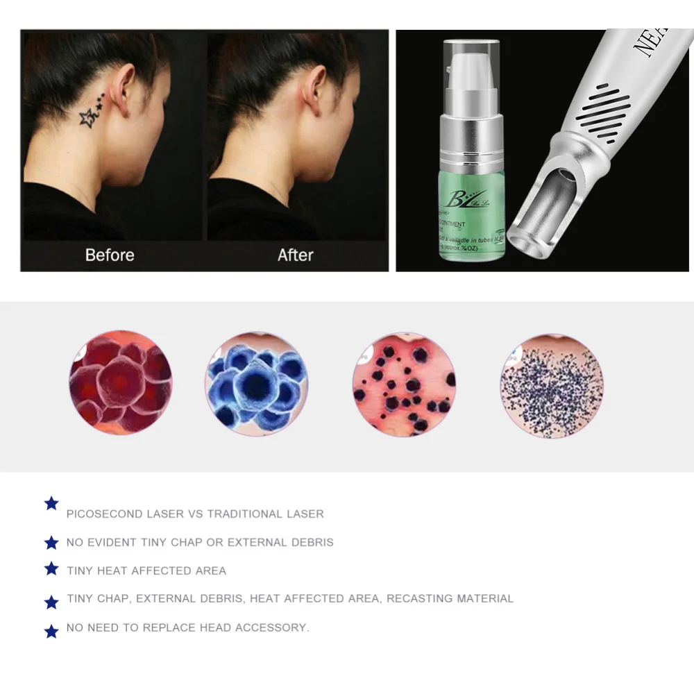 Picosecond лазерная ручка для удаления пятен машина красный синий светильник терапия