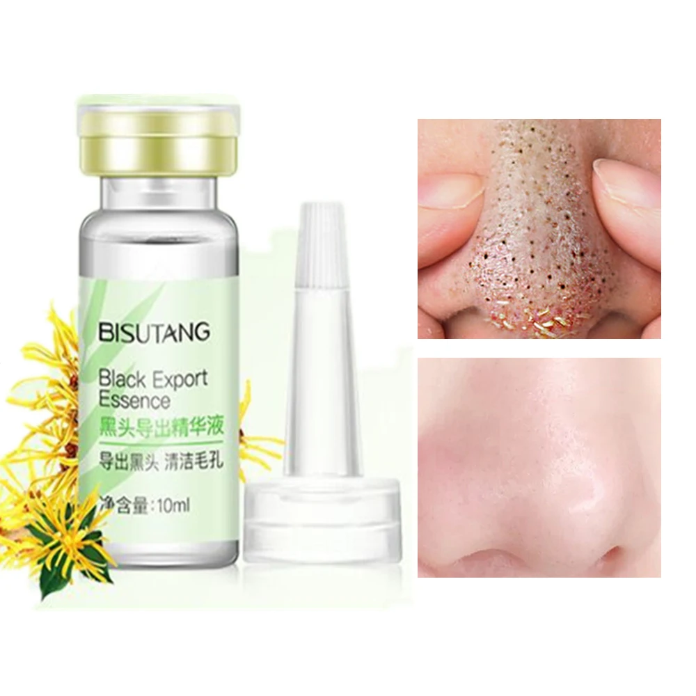 

Средство для удаления черных точек на лице