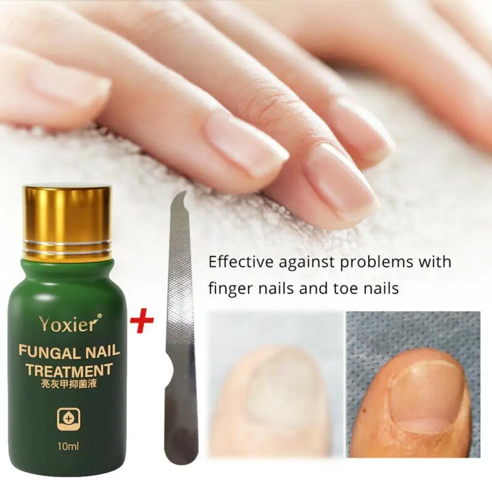

10ml Nail Repair Liquid Antibacterial Serum Repair Rough Discoloration Anti-infective Paronychia Onychomycosis Foot Care