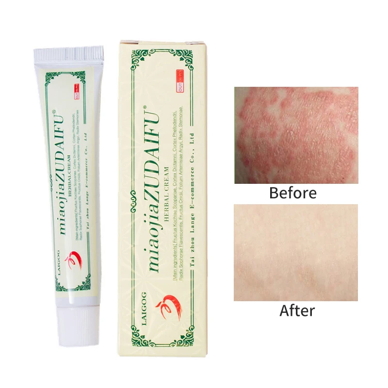 

1pc Zudaifu Psoriasis Cream Skin Care Cream Psoriasis Skin Cream Dermatitis Eczematoid Eczema Ointment Treatment 15g