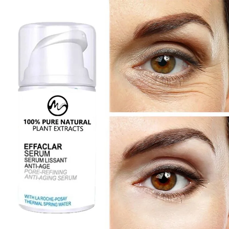 Minch мгновенный удалить против мешков под глазами крем для удаления кругов и гель