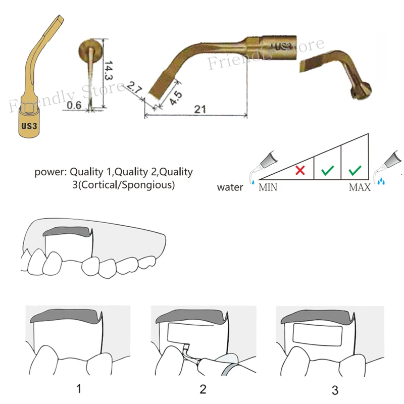

Dentistry Dentist 3PCS US3 Dental Equipment Dental Instrument For Sinus Lift Dental Piezo Surgery Tip For MECTRON And WOODPECKER