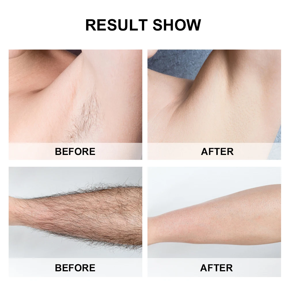 

Dropship 500000 Flashes Laser Epilator Permanent IPL Photoepilator Hair Removal Painless Electric Epilator Hair Remover