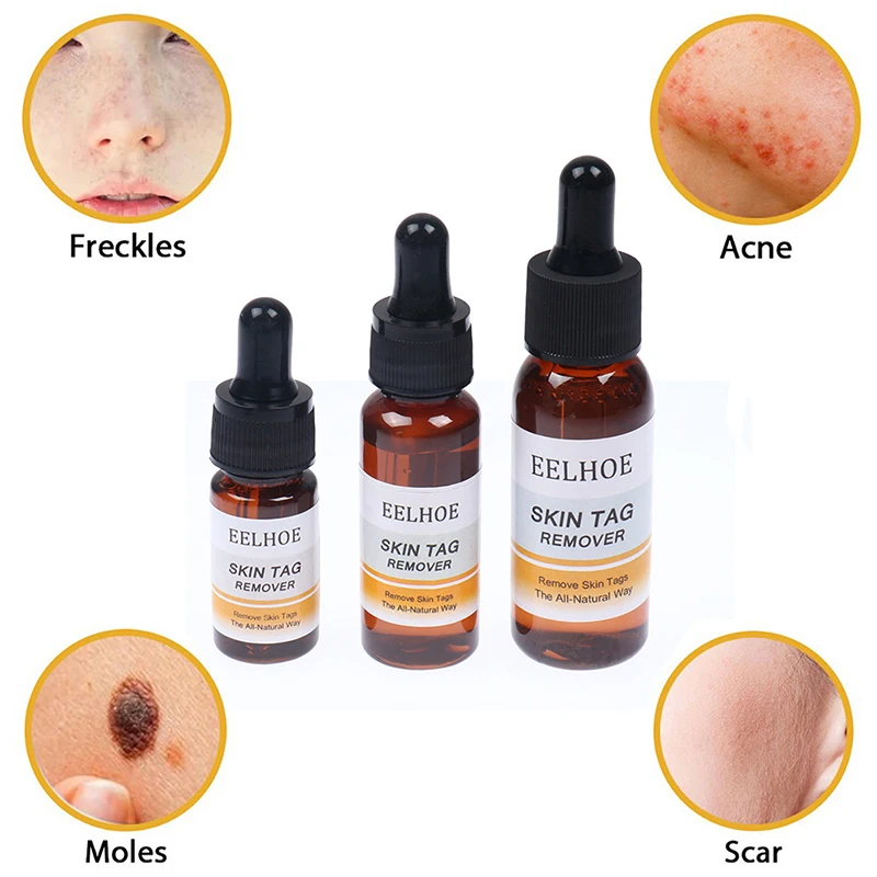 

10/20/30ML Genital Wart Treatment Papillomas Removal of Warts Liquid From Skin Tags Removing Liquid Against Moles Remover