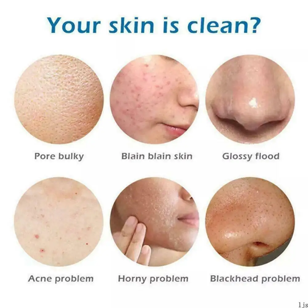 Турмерическое мыло Natural Ginger Anti-Acne для удаления темных пятен и шрамов, осветления кожи и ухода за ней, содержащее антибактериальное средство.