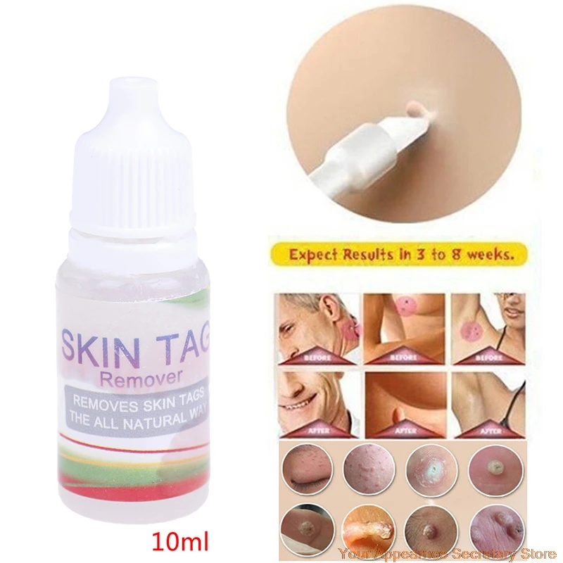 Skin Tag Mole Wart Remover Eye 12 Hours Liquid Foot Corn Removal 10ml |