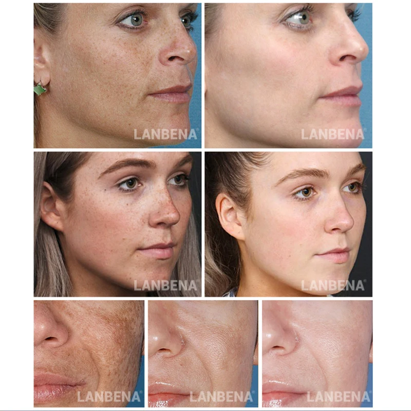 Lambena золотистое шелковое ампула коллагена лифтинг кожи Сыворотки для ухода за