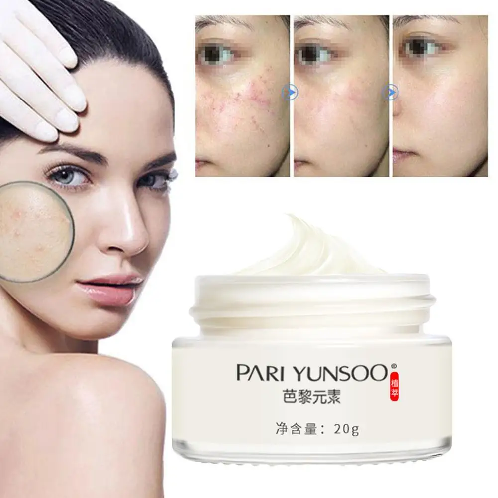Ginseng Acne Treatment Cream Anti Acne Pimples Spot Herbal Remove Blackhead Skin Care Removal Whitening Cream Cream Scar Na U9E6