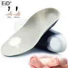 Ортопедические стельки EiD Kids, Детские 4d-стельки из ЭВА, поддержка вальгусного свода стопы OX, коррекция плоскостопия, стельки для ухода за ногами